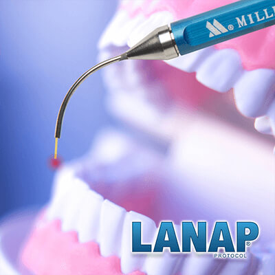 LANAP Protocol Mayfield Village OH - Periodontal Treatment